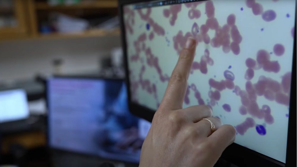 Finger pointing to microscopic image on a computer screen