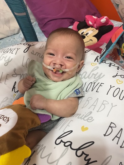 Jasiah as a baby before surgery